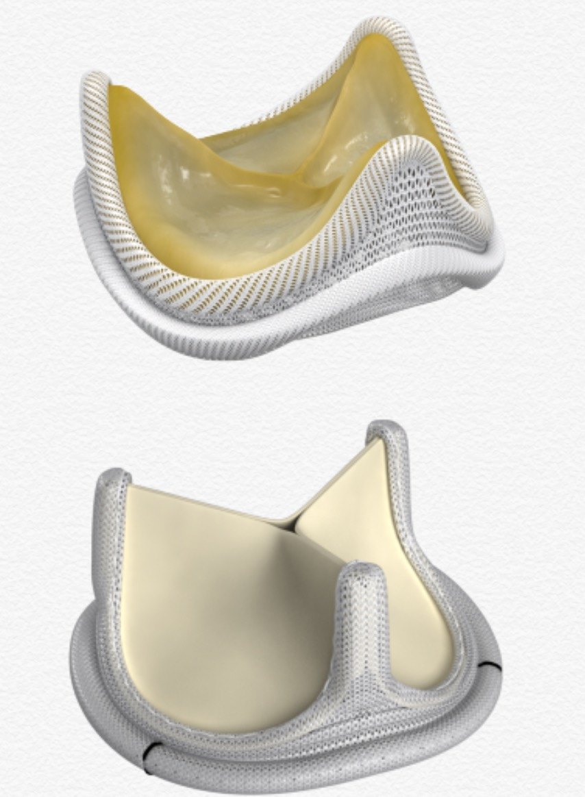 生物瓣膜适用人群* 因生活方式原因,不愿终生抗凝的患者* 孕期或有