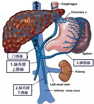 一方面是因为肝硬化的病人产生了门脉高压症,大量血液从食管胃底静脉