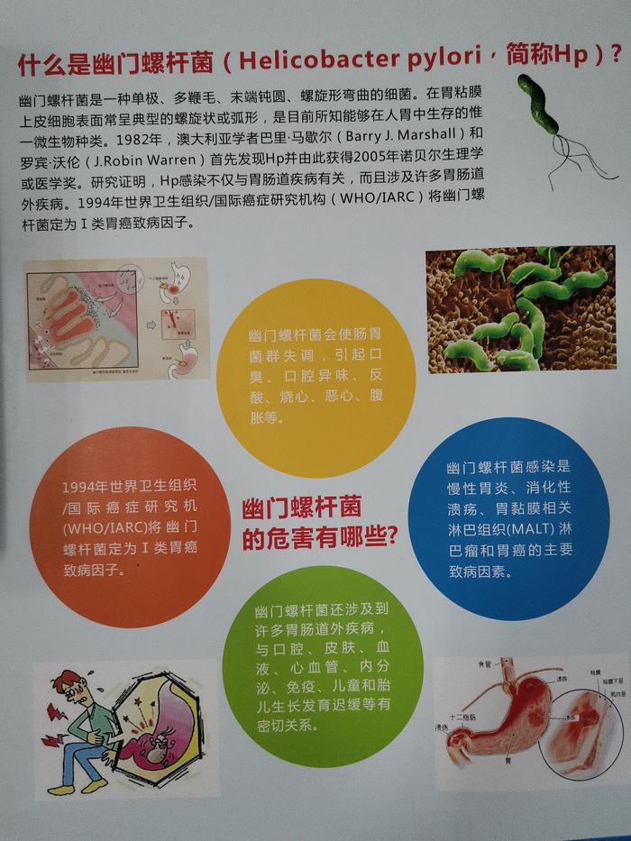 胃幽门螺杆菌hp检测碳14呼气试验