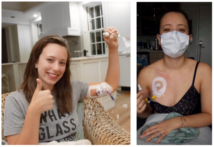 化疗丨一表告诉你化疗选择picc还是port _王建东医生文章_上海中医药