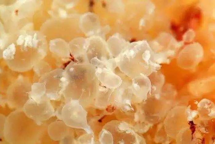 其实葡萄胎是个形象的名称,是因为怀孕的绒毛组织形成大小不一的水泡