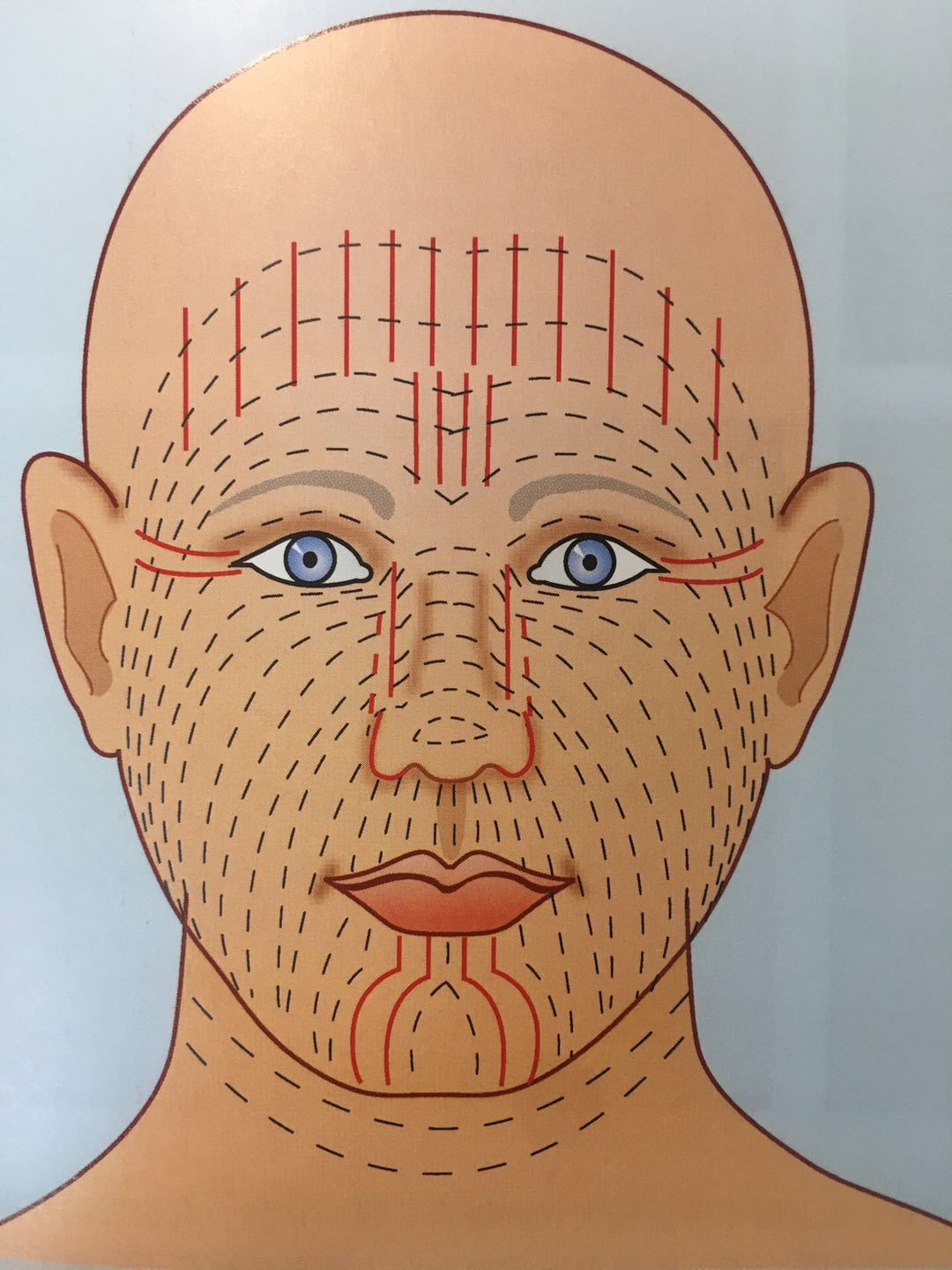 方向:皮肤有张力松弛线(郎格氏线),伤口与手术切口平行于该线者,所受