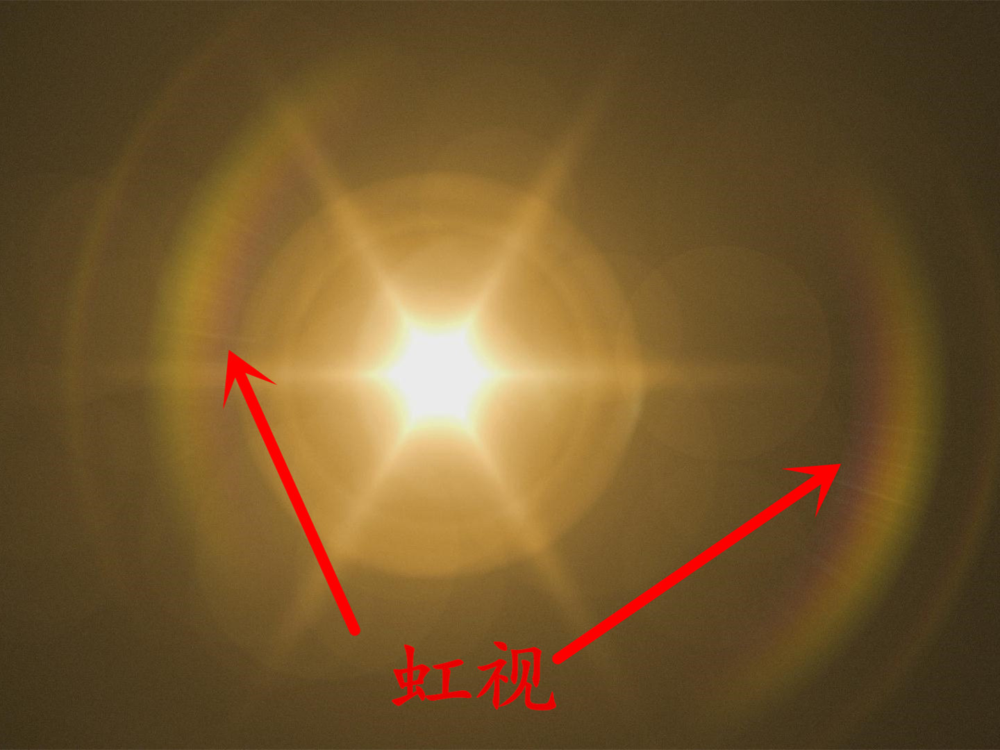 头痛症状不简单勿忘警惕青光眼