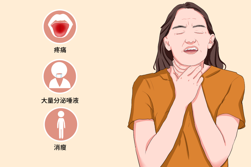 疼痛发生在一侧舌根,咽喉,扁桃体,耳根部及下颌后部,有时以耳根部疼痛
