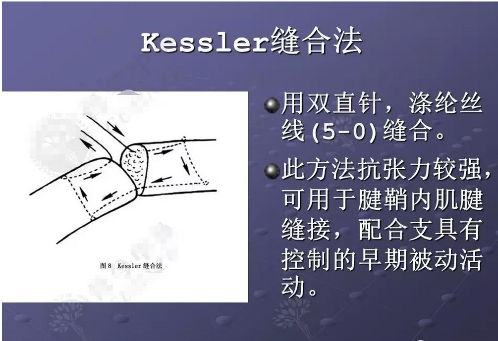 肌腱韧带损伤肌腱缝合的原则和方法汇总