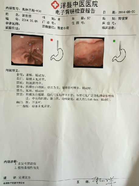 膏方治疗萎缩性胃炎患者的胃镜病理前后对照图片