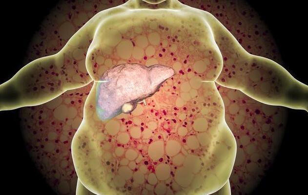 一旦晚上睡觉出现这3个异常不是肝炎就是肝硬化