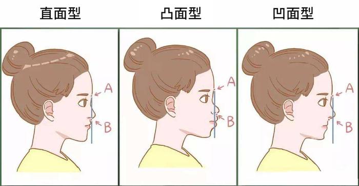 27岁带牙套也并不晚,矫正半年效果就出来 - 微医(挂号网)