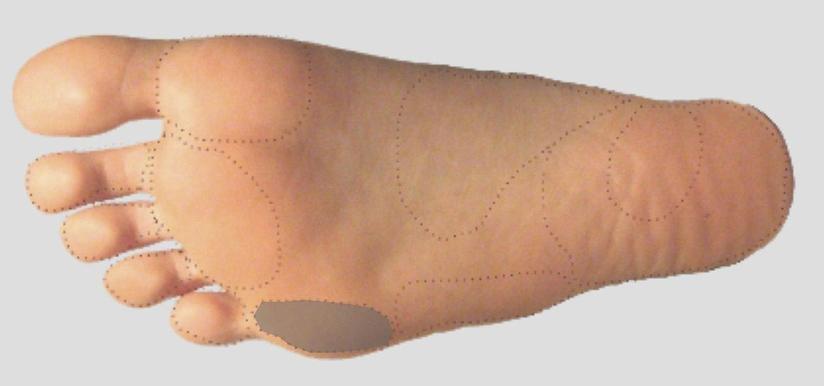 足踝教育篇 疼痛居家自查 二 足底 健康号 微医