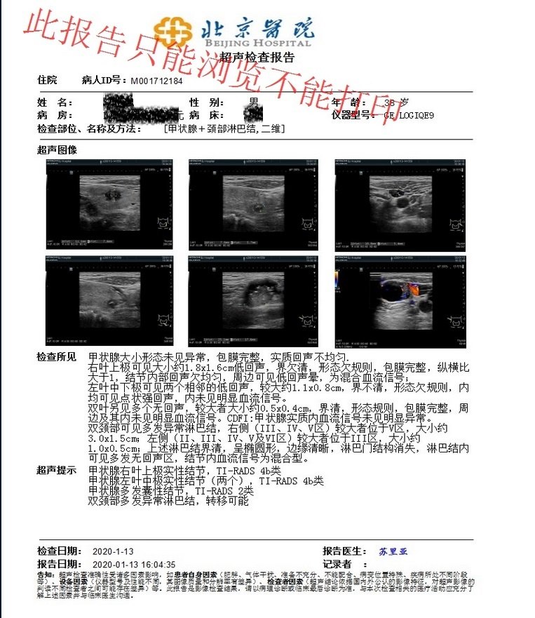 甲状腺双侧乳头状癌双侧颈侧区淋巴结转移可以同时双侧