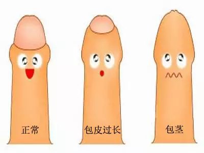 姚世杰医生文章_天津市第一中心医院-微医