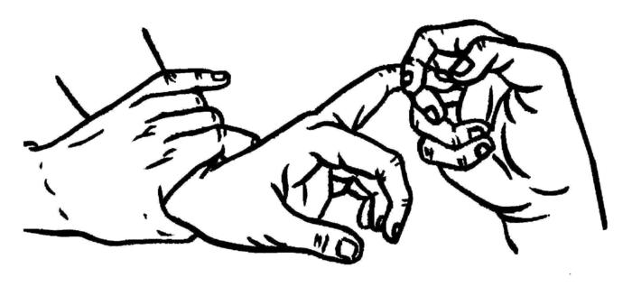 经常我在门诊会给患者做一个检查,就是霍夫曼征.