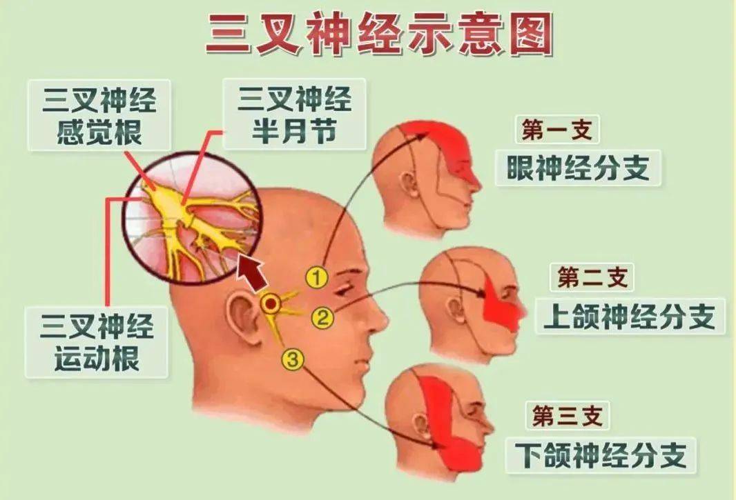 三叉神经简笔画图片