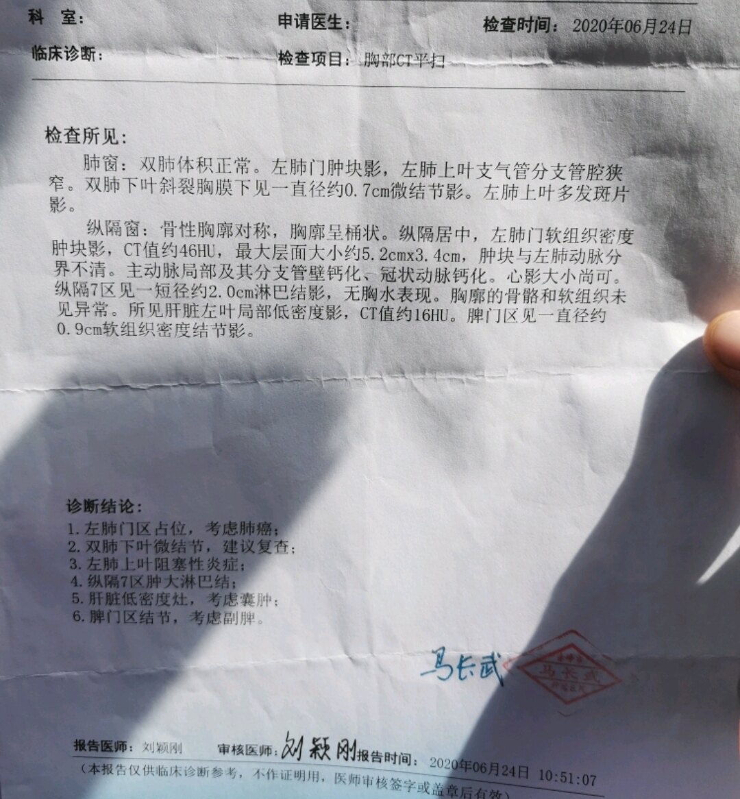 刘懿博士说肺癌一五亖〇做ct平躺和侧躺对肺占位大小有