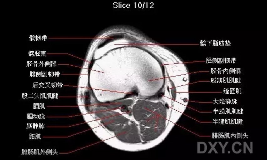 【关节影像】膝关节的磁共振(mri)解剖表现