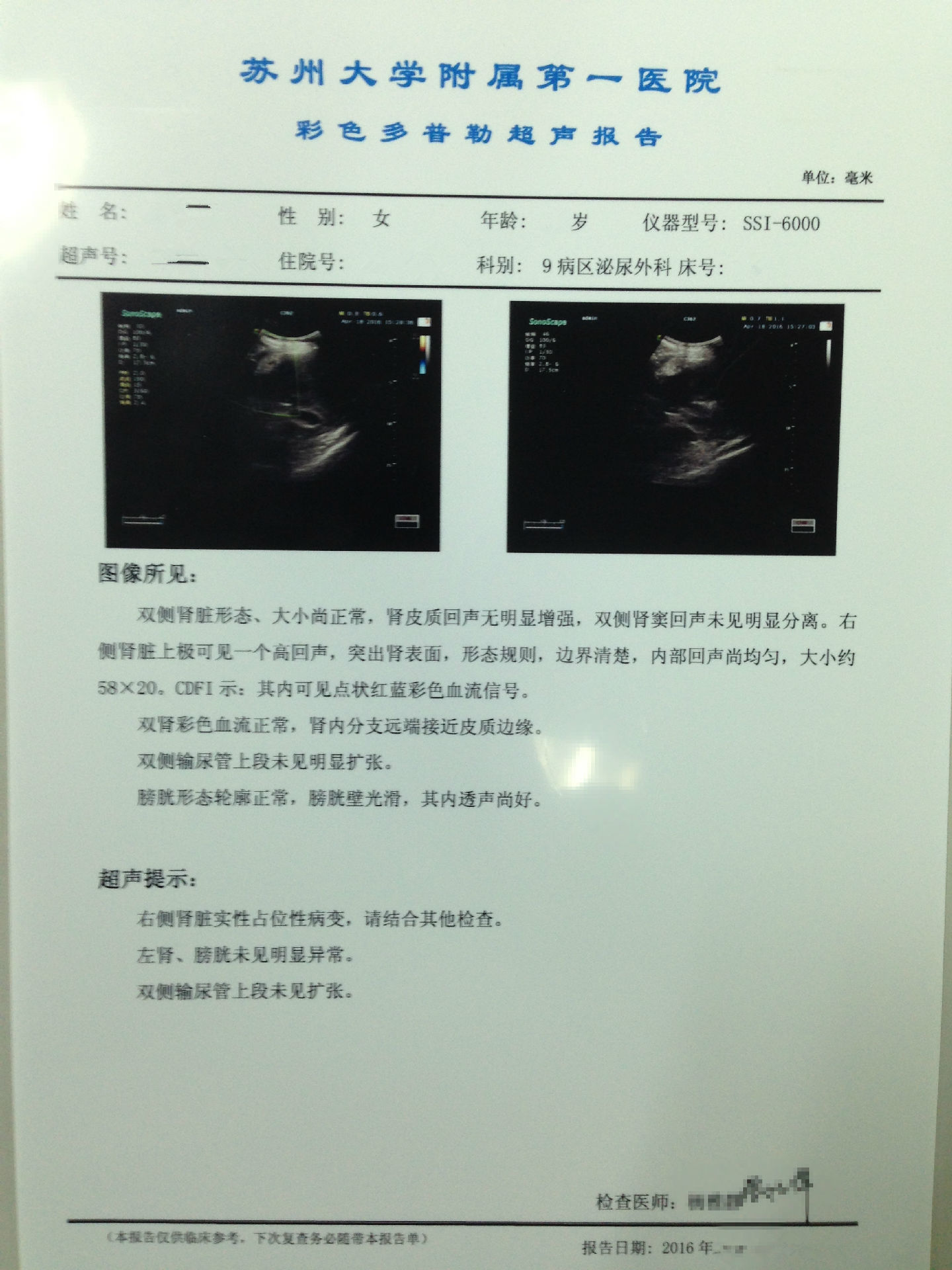肾错构瘤的微创保肾治疗