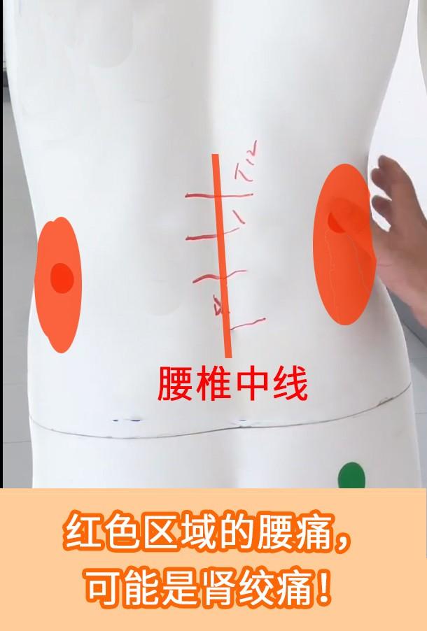 优雅的腰疼挂什么科的视图