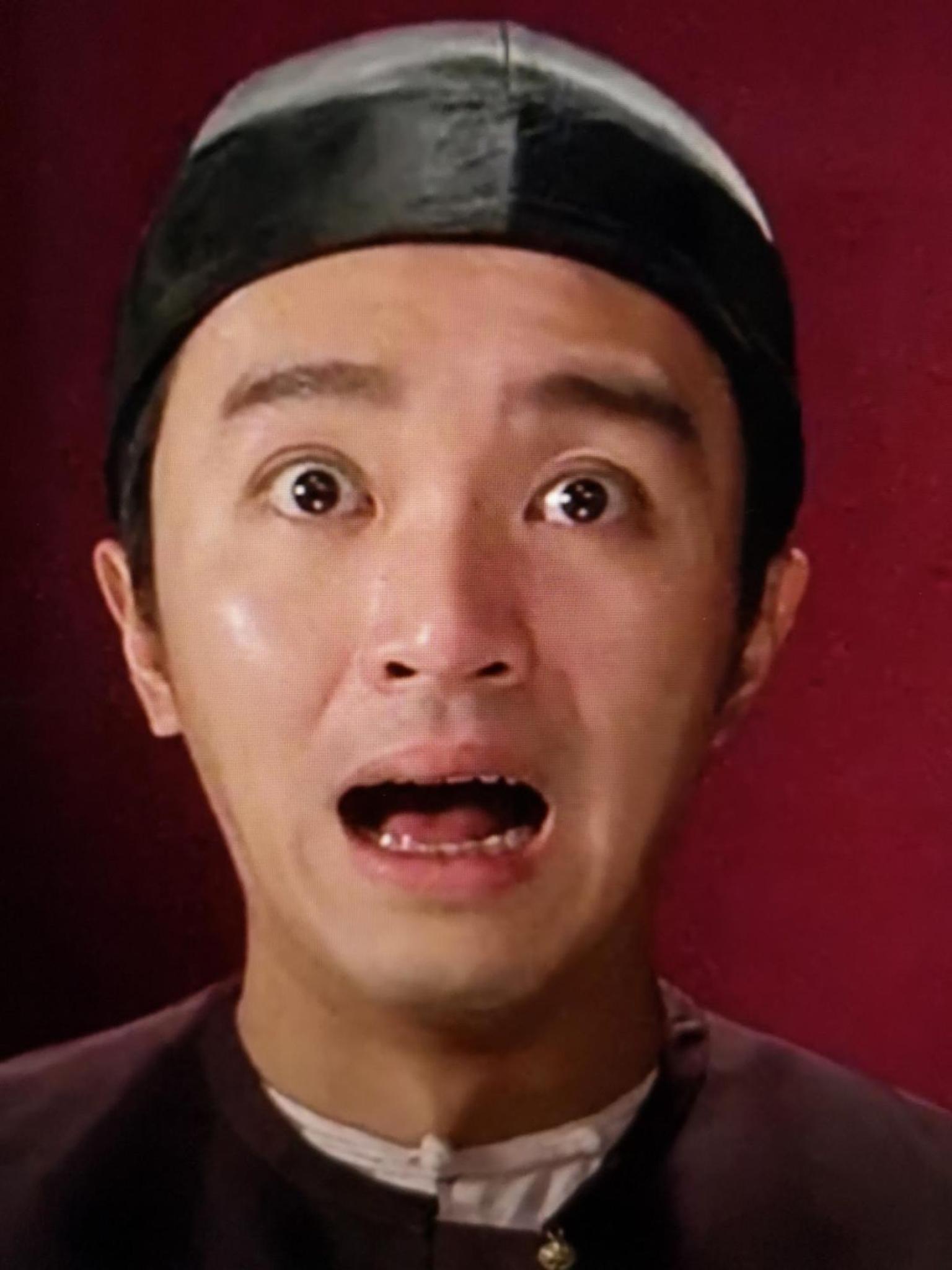 下巴咔吧响的烦恼颞下颌关节紊乱