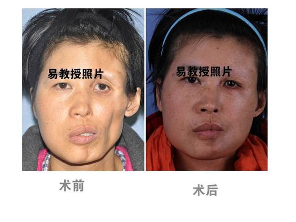 2018年07月11日【健康号】易成刚