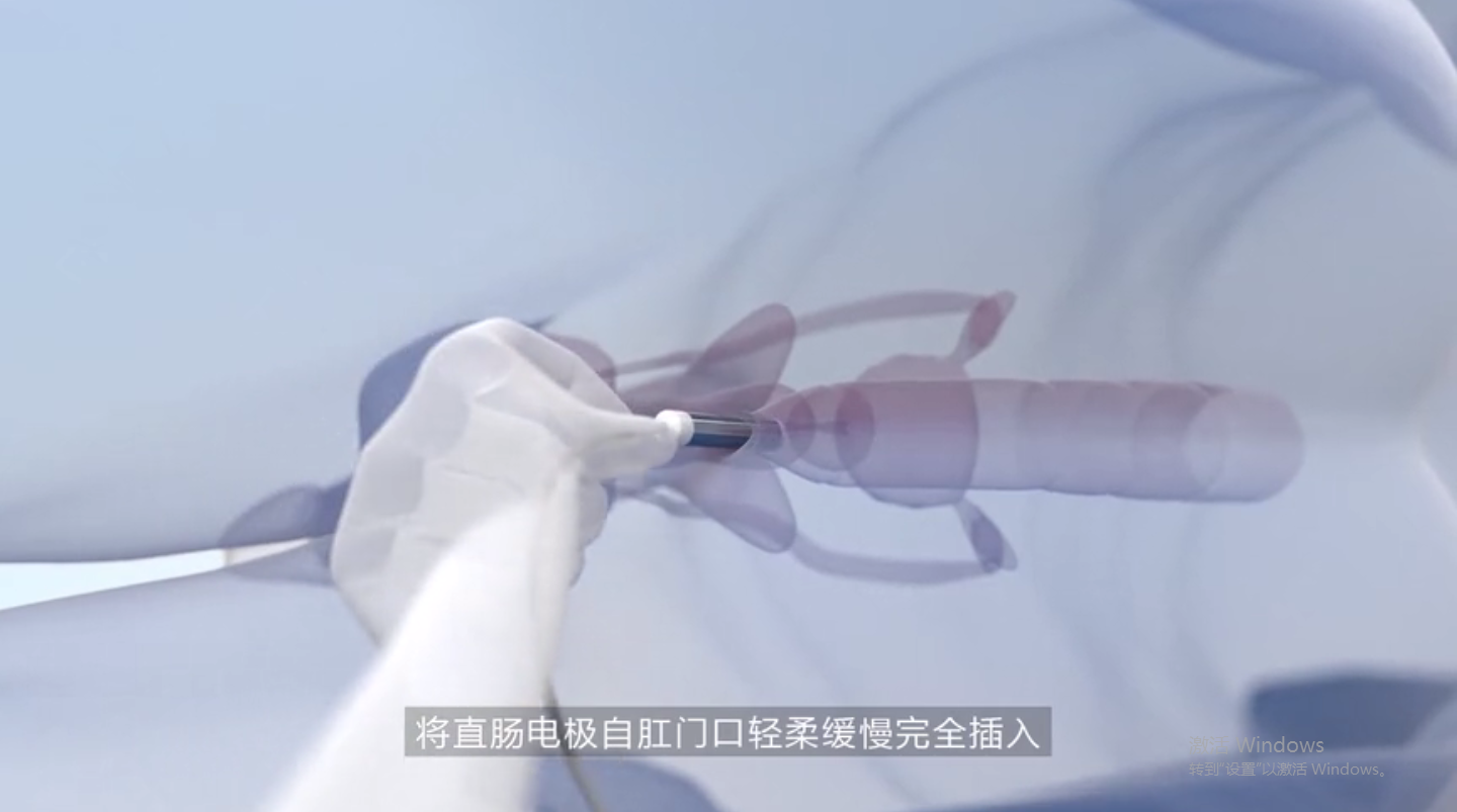 治疗慢性前列腺炎的新方法:前列腺场效消融仪(智源肽)