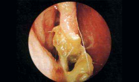鼻子干燥也是病得治