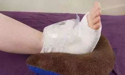 如果非常疼痛,可咨询医生使用止痛药;如果是不太严重的外侧踝关节扭伤