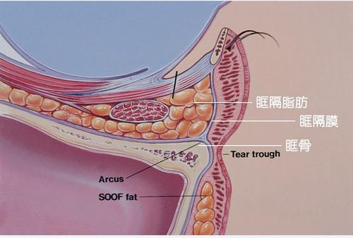 眼眶部网格化分区与脂肪移植