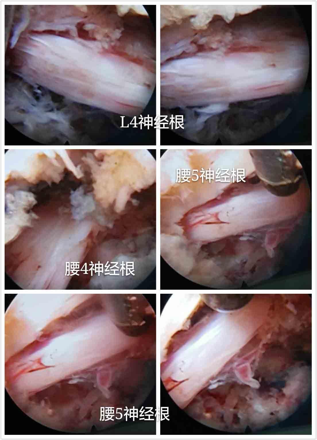 病因脊椎治疗学研究_病因脊椎治疗学实验报告_脊椎病因治疗学