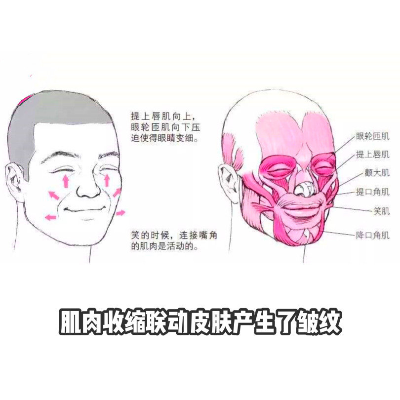 原创做了面部拉皮就能去除皱纹了吗你太天真了