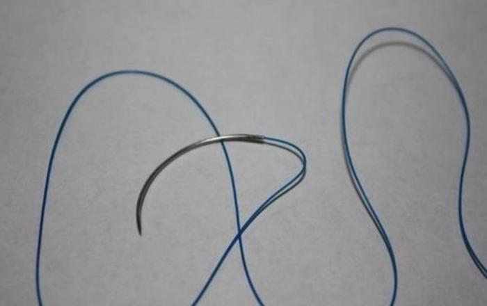 免拆线的拉皮手术有哪些优缺点