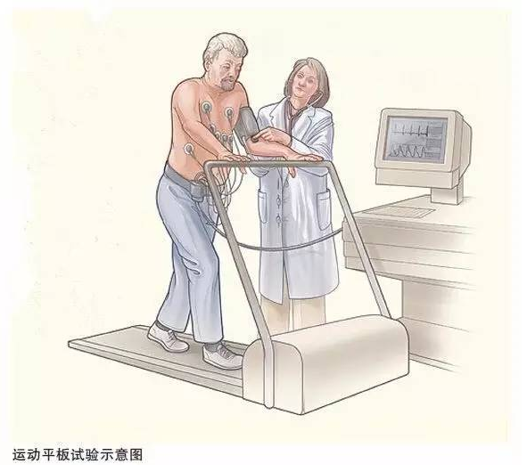 心基础运动心电图的临床应用