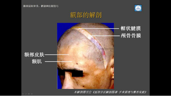 额颞部注射公益分享笔记整理