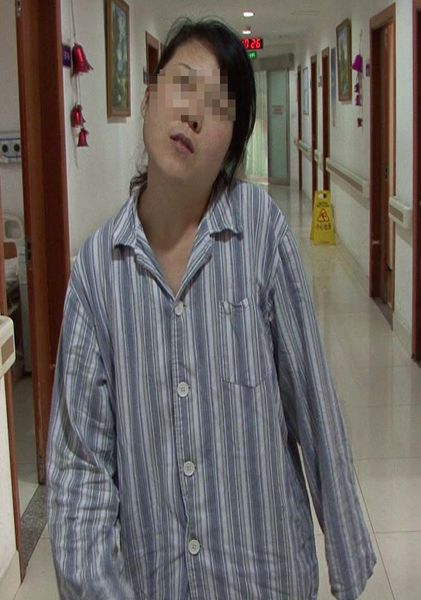 上海瑞金医院功能神经外科占世坤主任开展痉挛性斜颈微创外科治疗