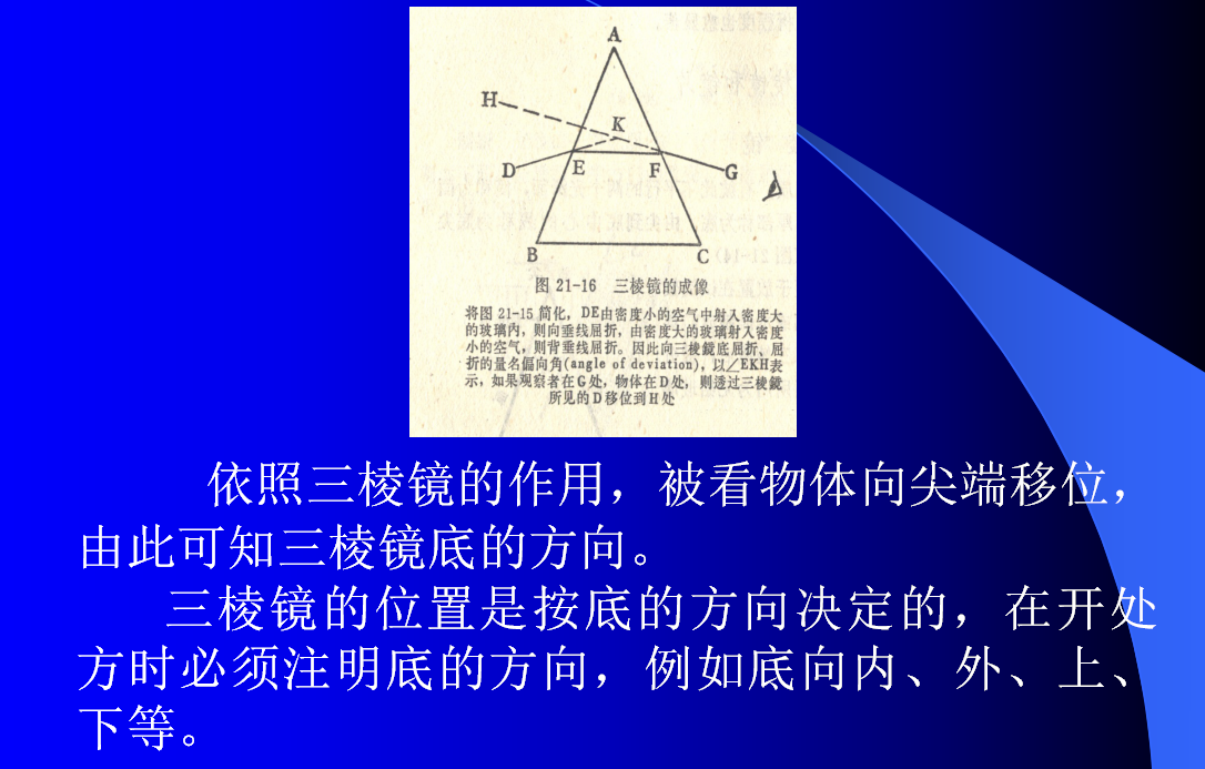 压贴三棱镜及压贴球镜基本原理,临床应用及操作_邓姿峰医生文章_湖南
