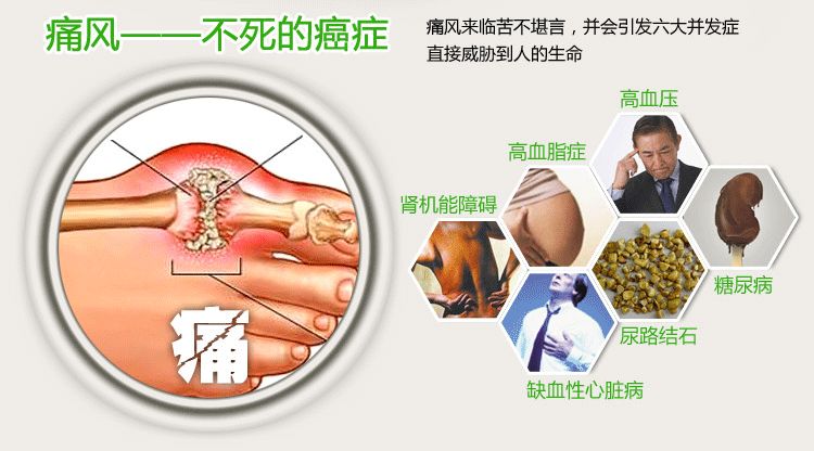 痛风中药