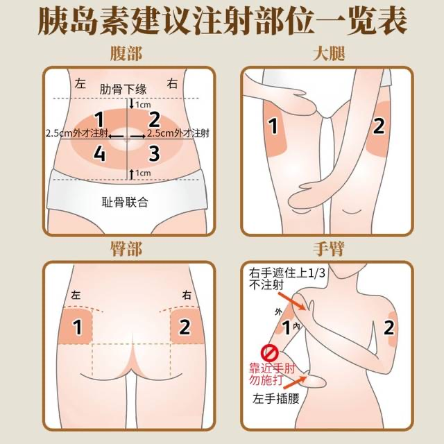 胰岛素注射的方法及技巧