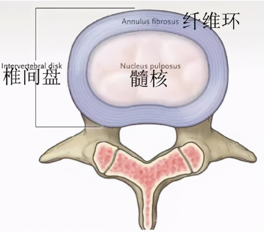 颈腰椎间盘突出后破裂的纤维环还能修复吗