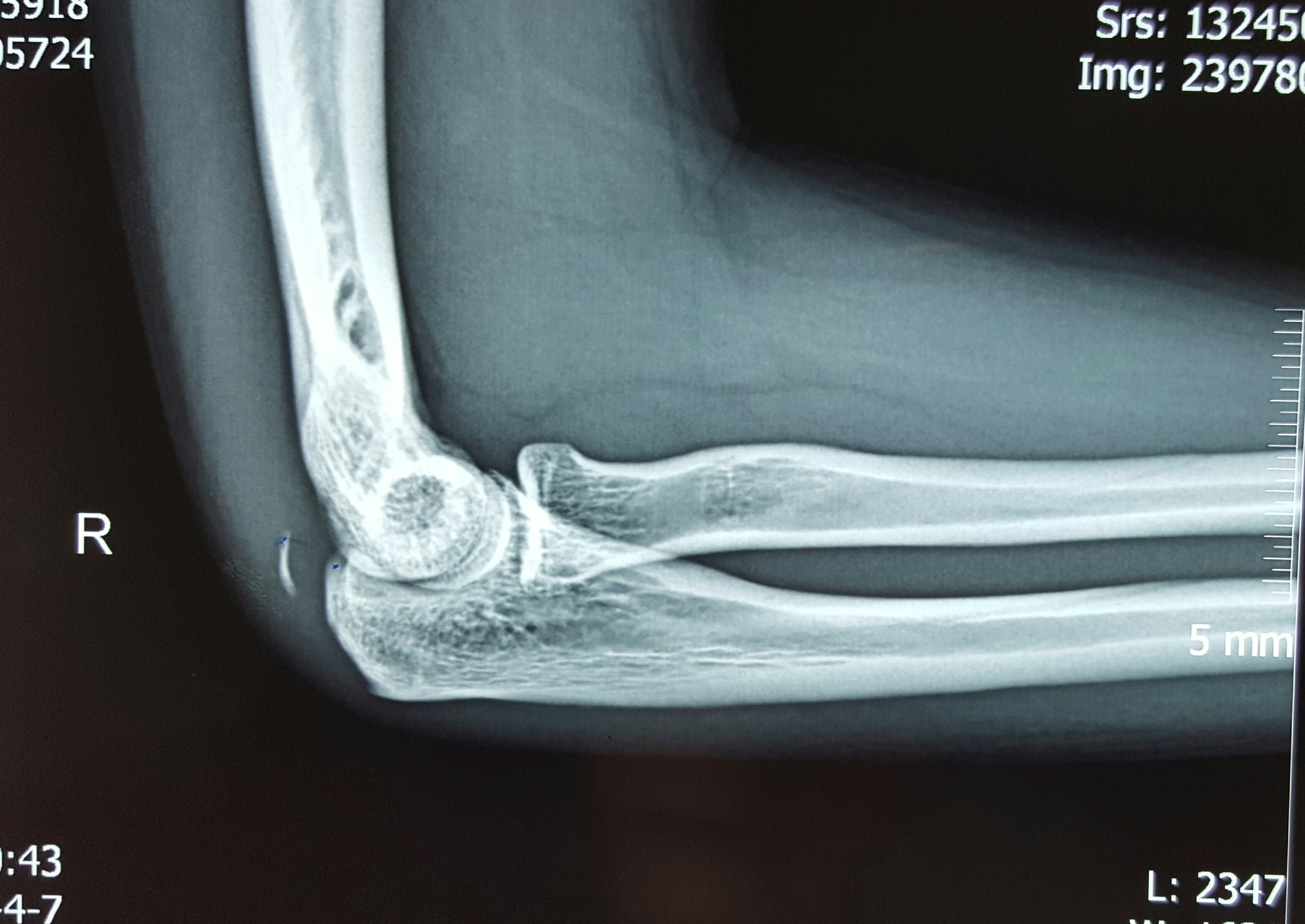 网上请医生诊治需上传高质量的片子