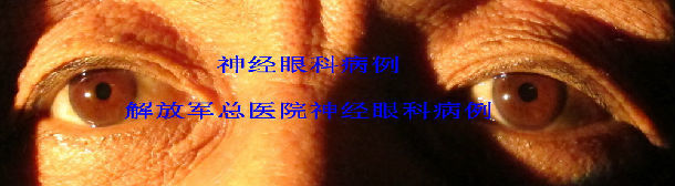 argyllroberston瞳孔神经梅毒一例