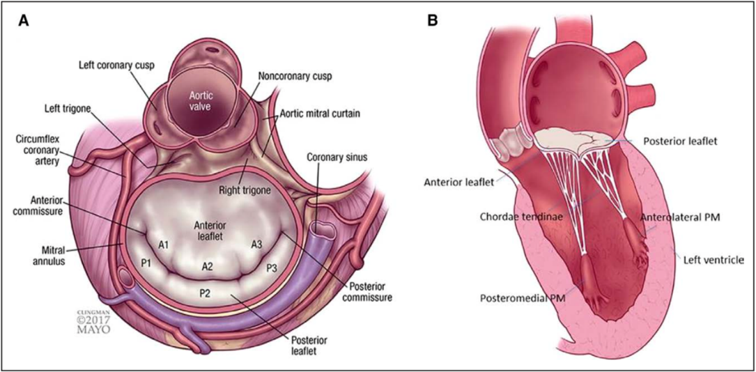 二尖瓣复合体(mitral apparatus:二尖瓣复合体包括二尖瓣瓣叶(mitral
