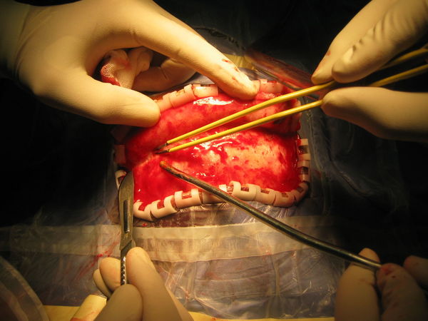 开颅手术不可怕 - 微医(挂号网)