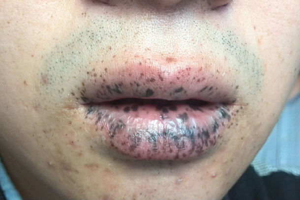 孩子嘴唇发黑医生却让我做检查