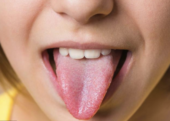 心在窍为舌,通过观察舌头,可简单判断出心脏是否健康.