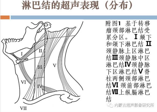 儿童颈部淋巴结超声表现