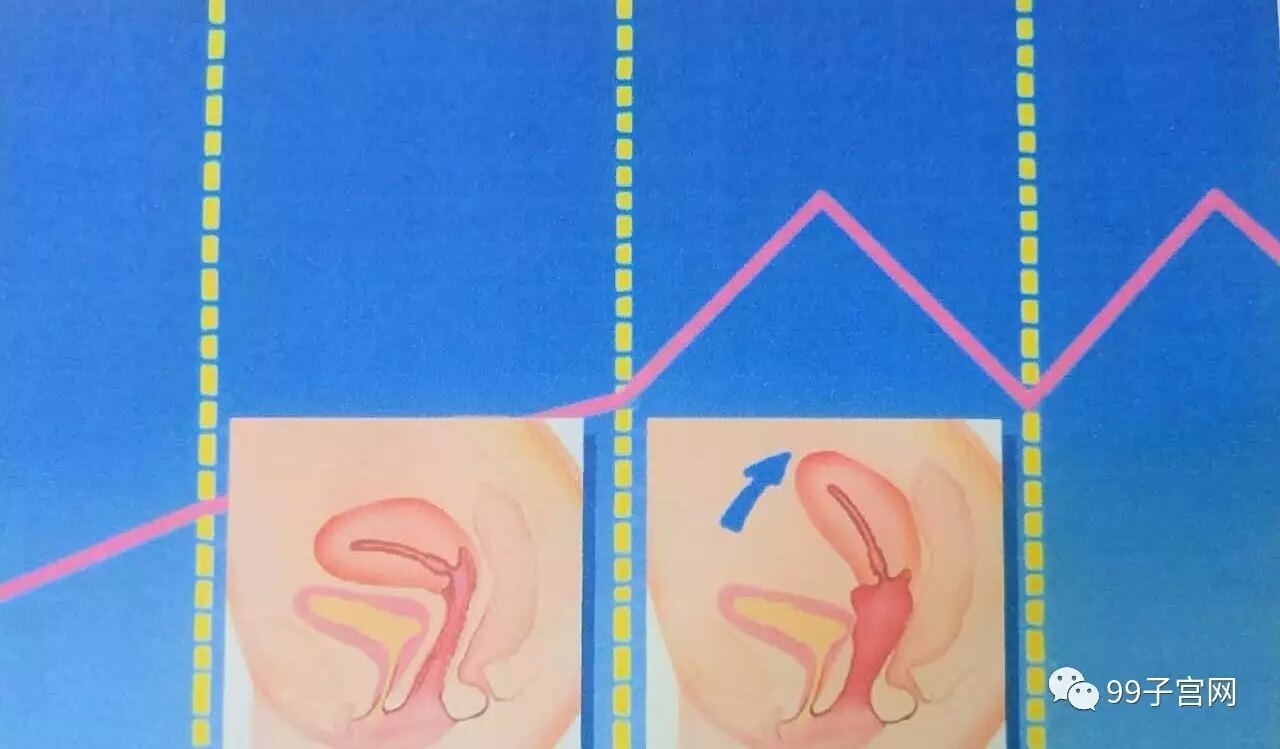 性爱过程中子宫会向上方缓慢移动,高潮期子宫的典型反应是子宫肌肉的