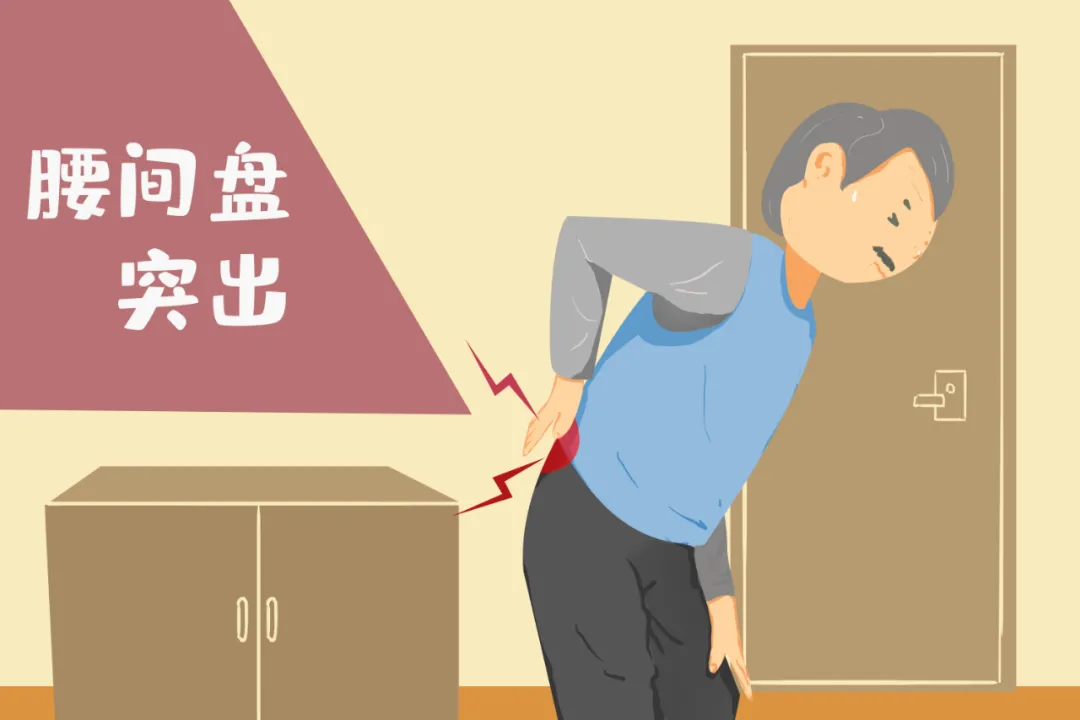 出现腰腿疼是肌肉疼痛还是椎间盘突出神经受压引起的疼痛