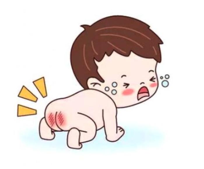 它被称为尿布疹,又叫尿布皮炎,婴儿红臀,通常出现在尿布覆盖的区域,经