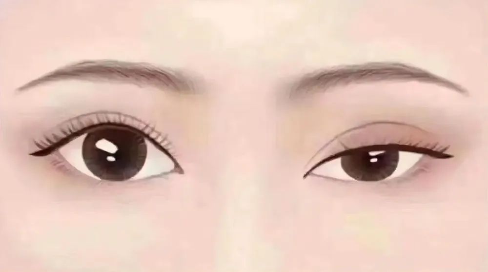 导致面部明显不对称的问题有哪些