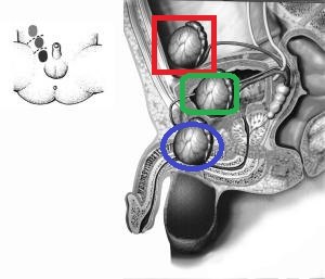 临床研究,发生隐睾的机会是1—7%,其中单侧隐睾患者多于双侧隐睾患者