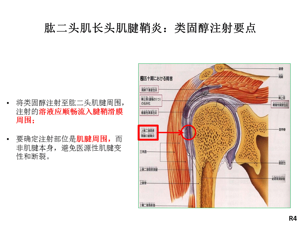 香港关节超声中级班听课笔记肩关节扫描及超声引导下穿刺